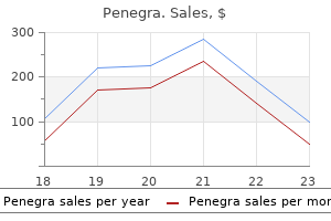 order penegra 100mg with amex
